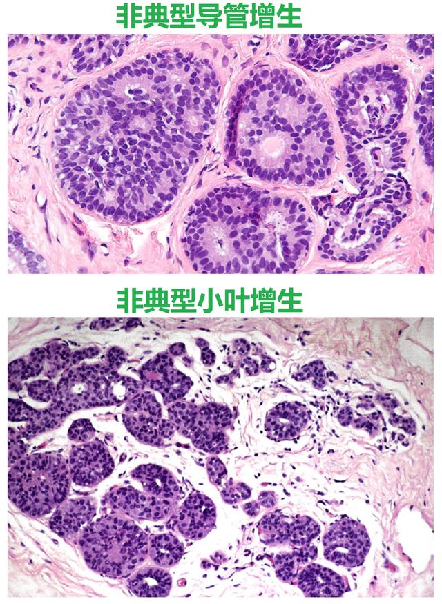 智商测试4.0答案18题-智商测试4.0第18题揭秘：逻辑思维与空间想象力的终极